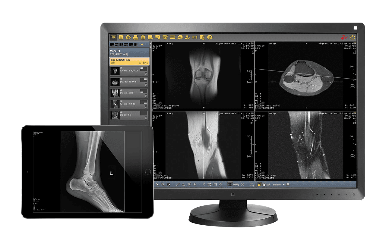 RIS - Radiology Information System